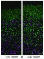 Zeit und Hirngr��e - von M�usen und Menschen