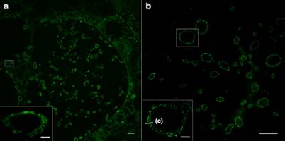 Zellmembranen super aufgel�st