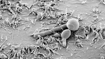 Altruismus in der Zelle