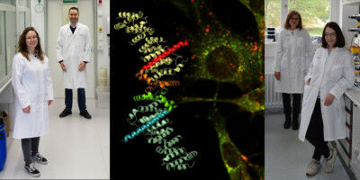 Forschungsteam untersucht Ursachen der Tuberösen Sklerose