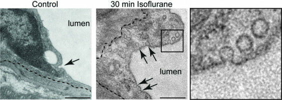 Inhalations-Anästhetika machen Blut-Hirn-Schranke durchlässiger