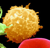 Interleukin-33 an Immunität gegen Sars-CoV-2 beteiligt