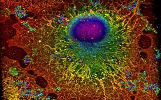 Maschinelles Lernen verbessert die biologische Bildanalyse