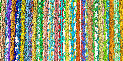 Scharfer Blick in die Muskelzelle