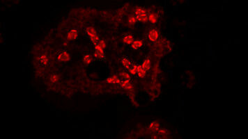 Verteidigungsb�ndnis: Mikroskopische Feinde im Visier