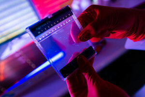 Genetischer Risikofaktor f�r Covid-19 sch�tzt vor HIV