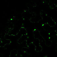 How invading pathogens switch off plant cells' defenses