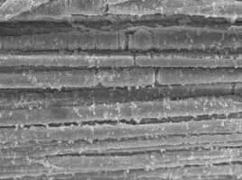 Knochen, gebaut wie Spannbeton