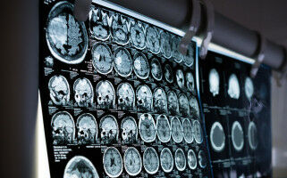 Show me your brain scan and I'll tell you how old you really are