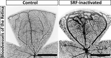 When smooth muscle cells lack strength