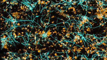 Wie sich Pilzinfektionen in der Lunge ausbreiten