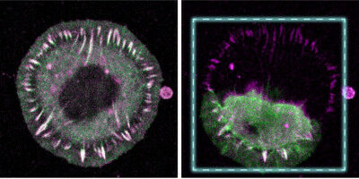 Bedeutung einzelner Moleküle bei mechanischer Belastung in Zellen nachgewiesen