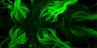 Forscher finden Strukturen zur schnellen Leitung von Nervenimpulsen bei Insekten