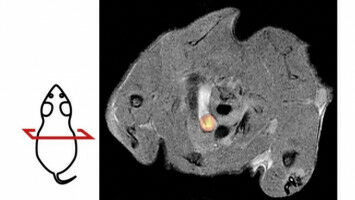 Gef��verkalkung sichtbar machen