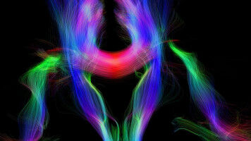 A foreign language is transforming the brain