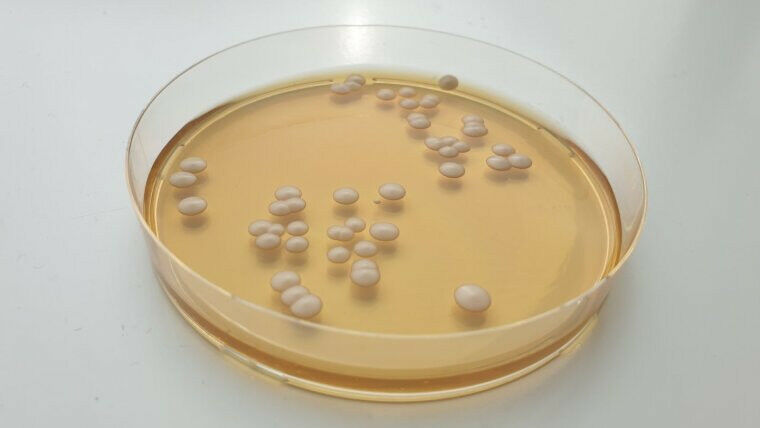 Kolonien von Candida parapsilosis. Foto: Grit Walther