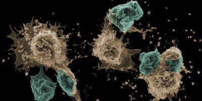 Studie gibt neue Einblicke in die Funktionsweise des Immunsystems