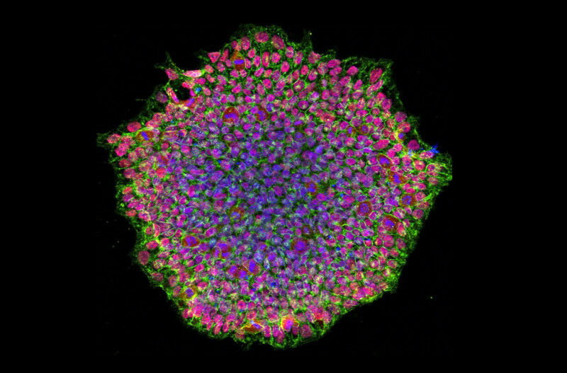 Confocal microscopic image of a colony of human induced pluripotent stem cells.