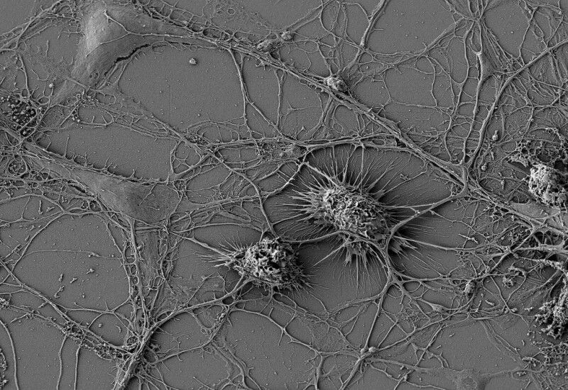 Mikroglia verbinden sich über Nano-Röhren direkt mit Nervenzellen. © Scheiblich/