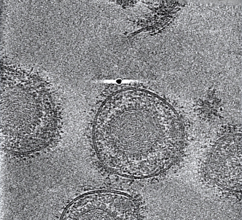 The researchers analyzed HSV-1 particles using cryo-electron tomography. The vir