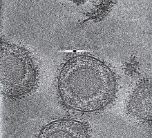 A nanobody against herpes