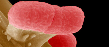 Antibiotika-Resistenz: KI-Vorhersagen unzuverl�ssig