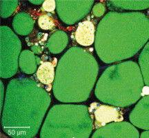 Fettzellen sind die W�chter unserer Gesundheit