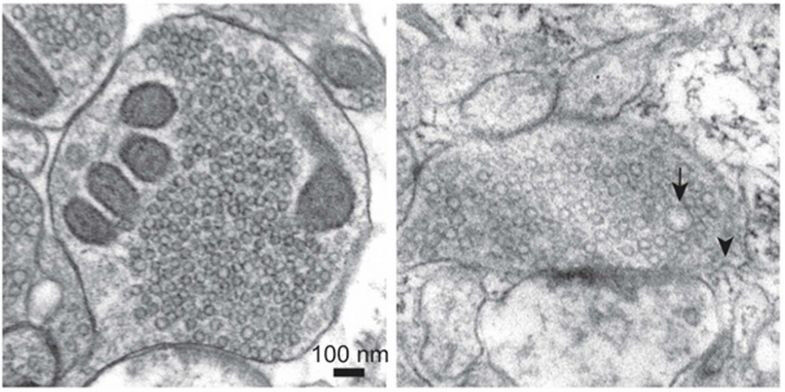 Left: a resting human synapse containing small vesicles that hold neurotransmitt