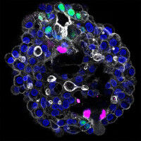 Patientenspezifisches Modell der Leber�