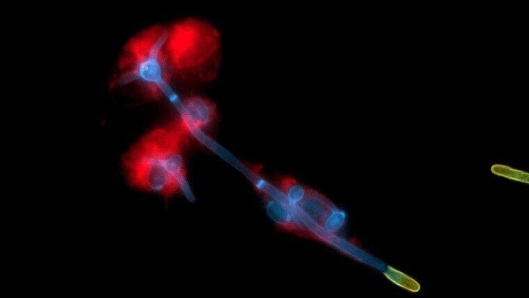 The yeast fungus Candida albicans (blue) breaks out of human immune cells (red)