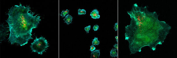 Wie Immunzellen ihre t�dliche Fracht abliefern