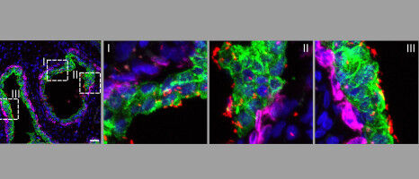 Der geheime Weg der Prostata-Infektionen