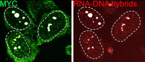 Entschl�sselt: Wie Krebszellen sich vor dem Immunsystem sch�tzen
