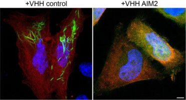 Neue Einblicke in die menschliche Immunabwehr gegen Pockenviren