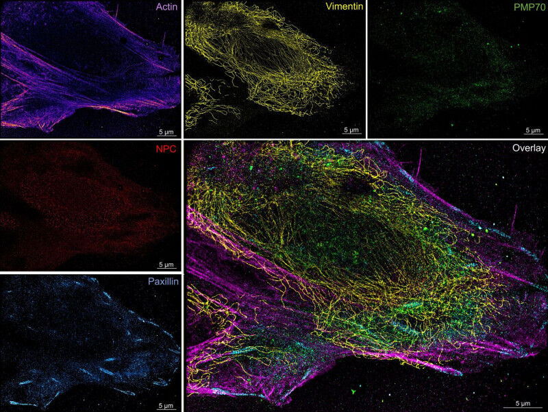 Multiplexed super-resolution image of targets inside the same U2OS cell taken us