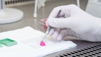 3D-Hautinfektionsmodell ersetzt Tierversuche