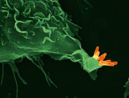 Biosignatur der Tuberkulose