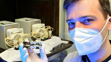 Chronisch entz�ndliche Darmerkrankungen im Chip-Modell