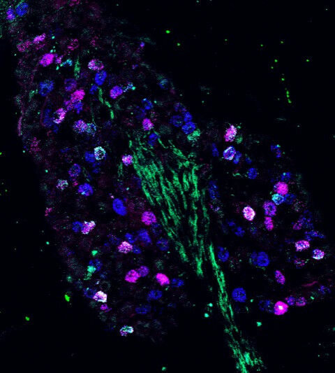 Fluoreszenzmikroskopie-Bild von genetisch unterschiedlichen Nervenzellen im Nodo