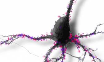 Das Gehirn vernetzt sich von allein