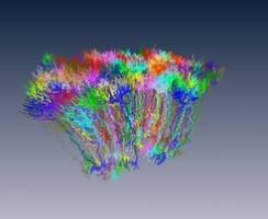 Das Konnektom des Gehirns - von Verzweigung zu Verzweigung