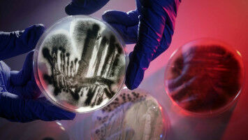 Das Wechselspiel von Materie und Kraftfeldern verstehen