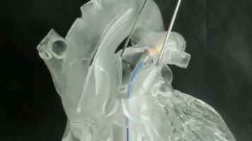 Diagnose-Verfahren der Zukunft