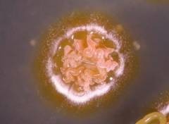 Bakterien unter dem Mikroskop. Fotos:   H.-P. Fiedler, Universit�t T�bingen