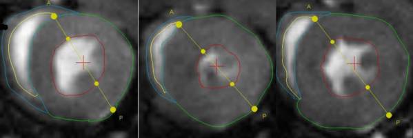 Enzym stoppt Alterungsprozesse in Zellen