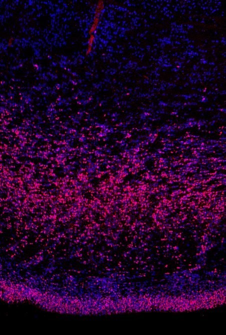 Dieses Bild ist im sich entwickelnden menschlichen Gehirn aufgenommen. Blau sind