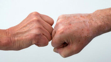 Kehrt der Handschlag wieder zur�ck?