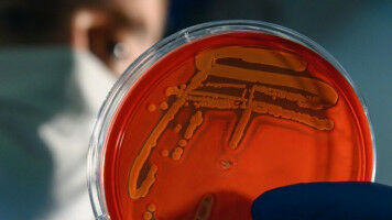 Kipppunkte im Mikrokosmos