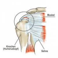 Millionen-Unterst�tzung f�r Implantat-Forschung