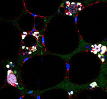 Neue Forschungsgruppe zu Leberkrebs erh�lt F�rderung